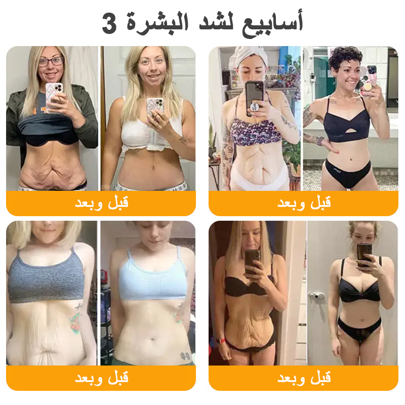 كريم VLSVLS® سم النحل لتجديد البشرة💥 (👩⚕️ مناسب لجميع الأعمار، موصى به من AAD) – مضاد للشيخوخة، يرطب، يعيد حيوية البشرة ويوحد لونها
