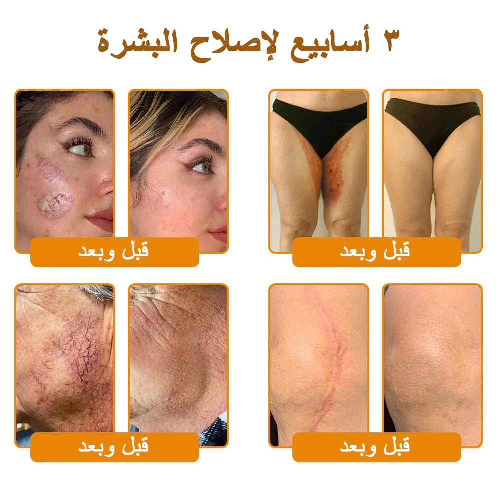 كريم VLSVLS® سم النحل لتجديد البشرة💥 (👩⚕️ مناسب لجميع الأعمار، موصى به من AAD) – مضاد للشيخوخة، يرطب، يعيد حيوية البشرة ويوحد لونها