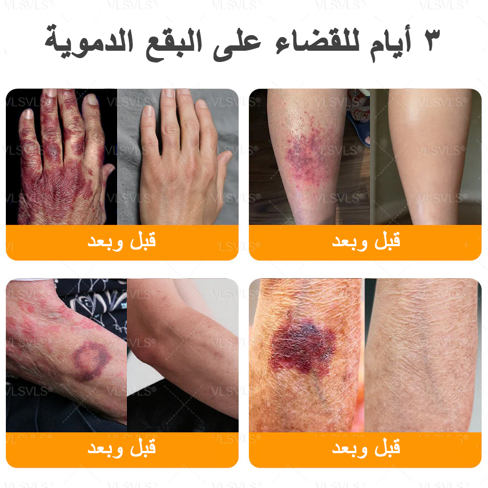 كريم VLSVLS® سم النحل لتجديد البشرة💥 (👩⚕️ مناسب لجميع الأعمار، موصى به من AAD) – مضاد للشيخوخة، يرطب، يعيد حيوية البشرة ويوحد لونها
