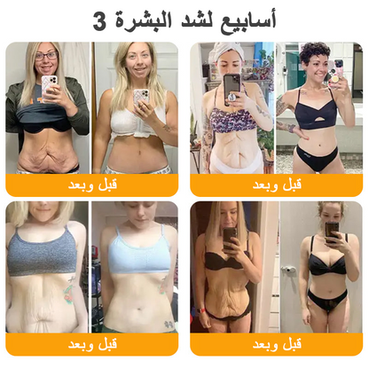 كريم VLSVLS® سم النحل لتجديد البشرة💥 (👩‍⚕️ مناسب لجميع الأعمار، موصى به من AAD) – مضاد للشيخوخة، يرطب، يعيد حيوية البشرة ويوحد لونها