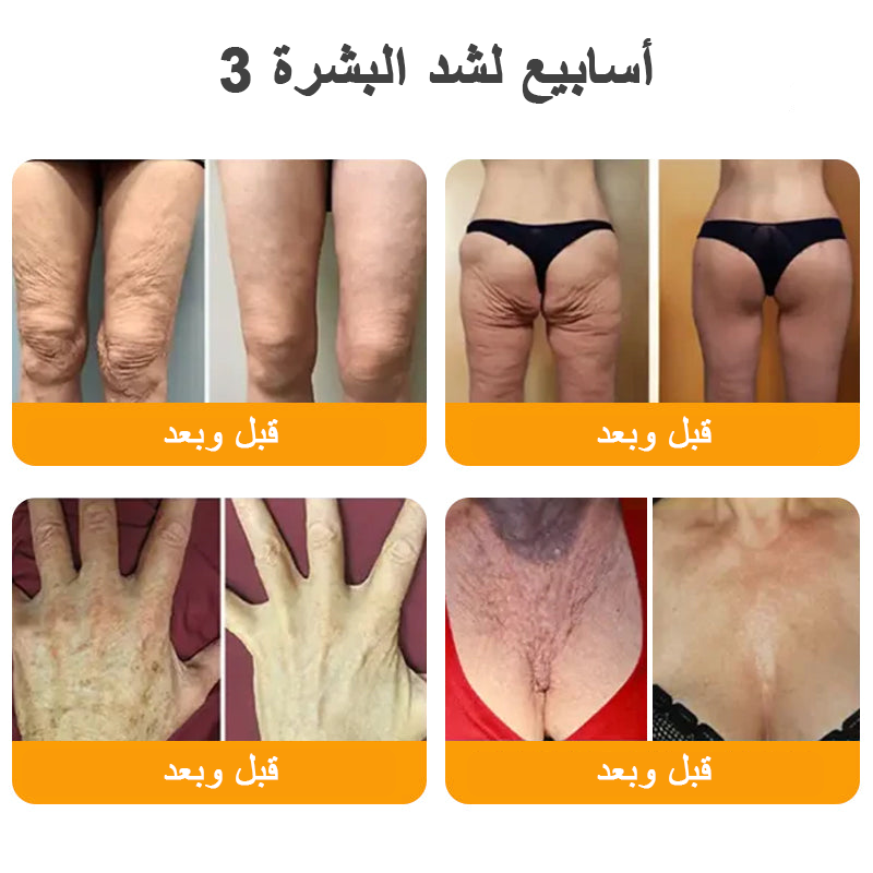 كريم VLSVLS® سم النحل لتجديد البشرة💥 (👩‍⚕️ مناسب لجميع الأعمار، موصى به من AAD) – مضاد للشيخوخة، يرطب، يعيد حيوية البشرة ويوحد لونها