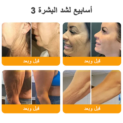 كريم VLSVLS® سم النحل لتجديد البشرة💥 (👩‍⚕️ مناسب لجميع الأعمار، موصى به من AAD) – مضاد للشيخوخة، يرطب، يعيد حيوية البشرة ويوحد لونها
